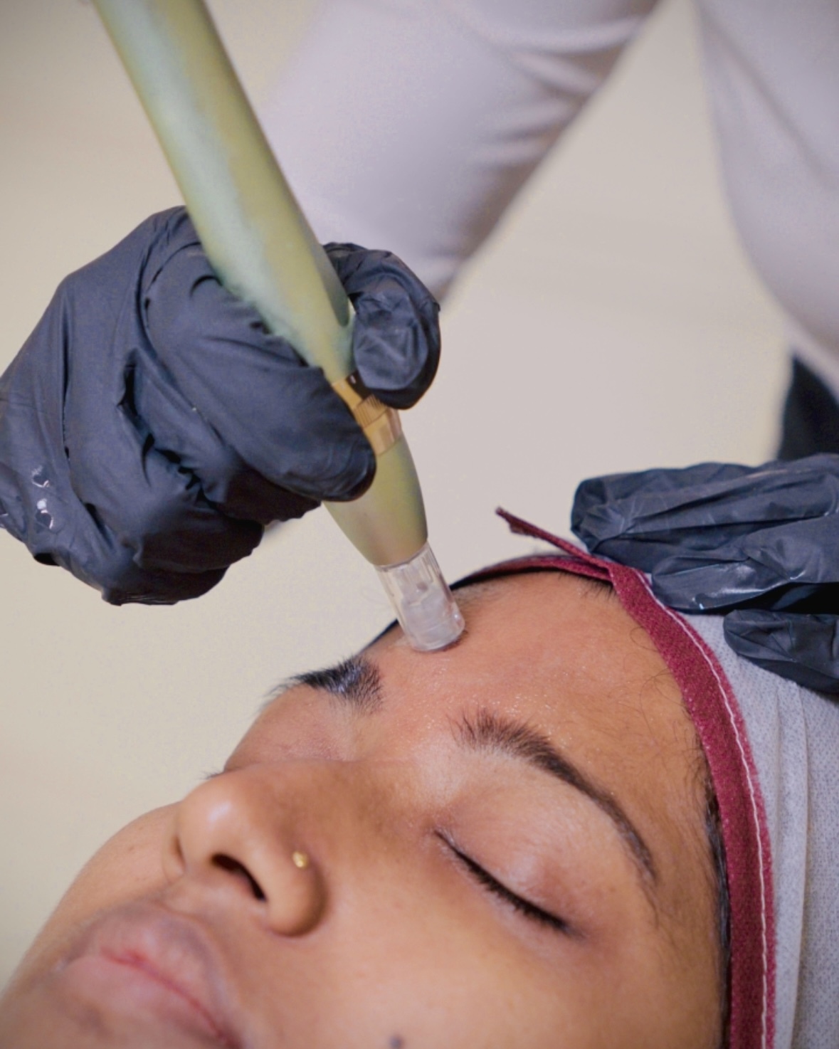 BB Glow Treatment